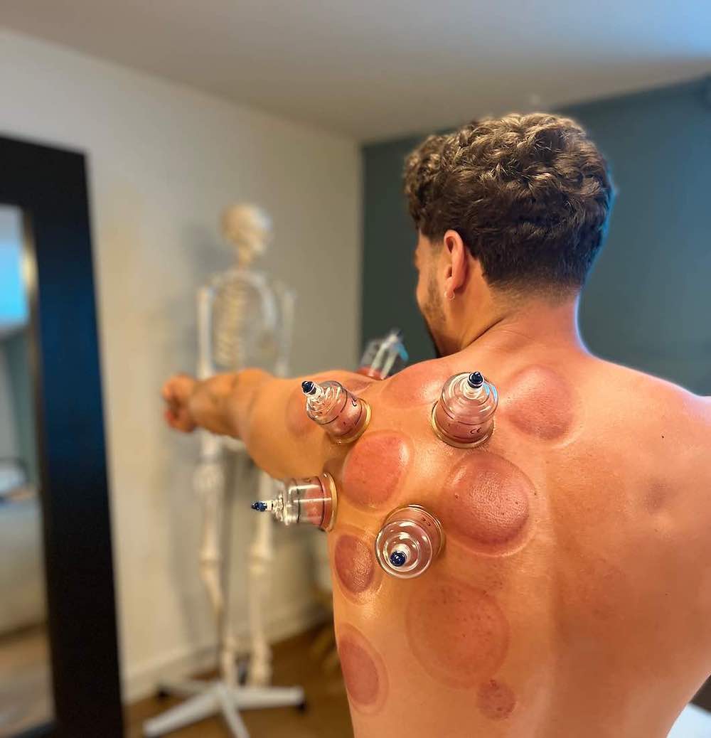 massage + cupping therapy geneve lausanne fribourg